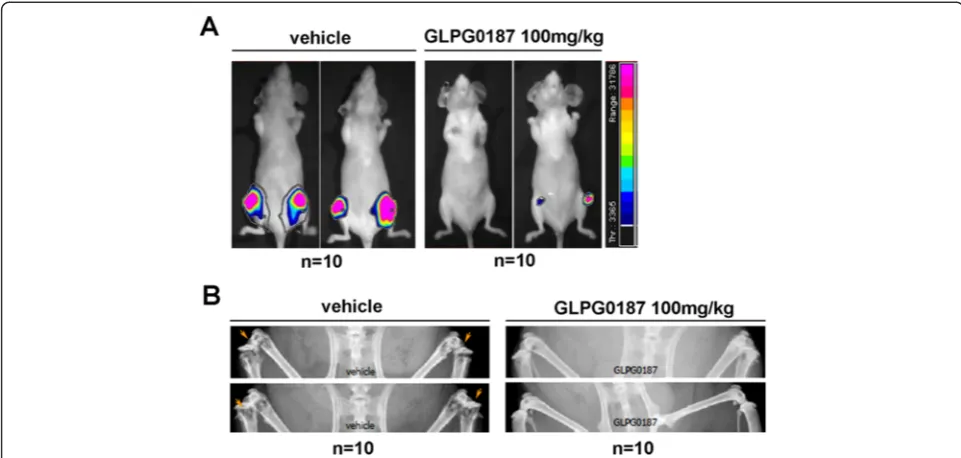 Figure 6 GLPG0187 inhibits progression of established bone metastasis. (A)injected with MDA-MB-231 cells and administered with vehicle or GLPG0187 (100 mg/kg) weekly