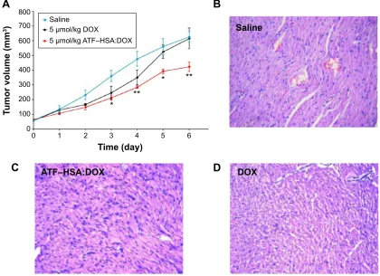 Figure 7 In vivo antitumor efficacies of ATF–HSA:DOX and DOX on H22 tumor-bearing mice (n=8 per group) and representative histopathologic images of hearts resected from mice after treatment with 0.9% saline, ATF-HSA:DOX or free DOX for 6 days.Notes: (A) In