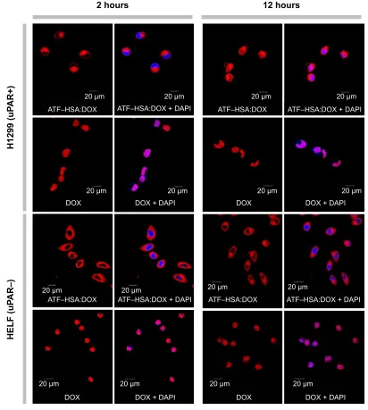 Figure 3 Cellular localization of ATF–HSA:DOX and DOX.Notes: aTF–hsa:DOX (5 μM) mainly distributes in cytoplasm, whereas DOX (5 μM) mainly localizes in nucleus in both H1299 cells and HELF cells after a 2 hours or  12 hours incubation period