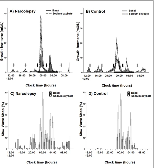 Figure 3.1 Mean serum growth hormone concentrations and slow-wave sleep in narcolepsy and  matched control subjects