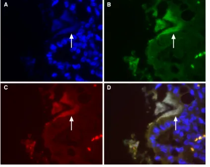 FIG. 2. Fluorescence in situCy3 (red ﬂuorescence) identiﬁes the eubacteria asof enteroadherent bacteria with eubacterial andnuclear counterstain, DAPI (4within the enteroadherent bacteria (arrow) can be seen in the lumen along the junction of two intestina