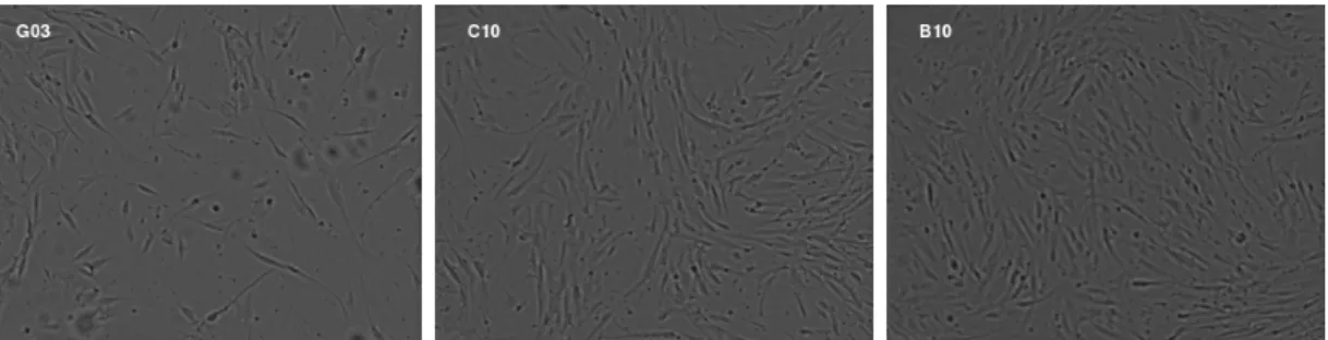 Figure 2.2: Pre-processed and intensity-normalized bright field images of three different wells from a 96-well plate of adherent stem cells, sorted from low confluence level to high confluence level