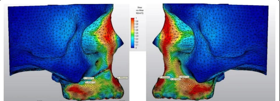 Fig. 6 Frontal view of the stressed areas in the skull model