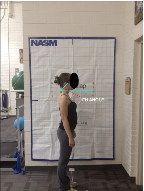 FIGURE 2:  Forward Head Angle (FHA) 