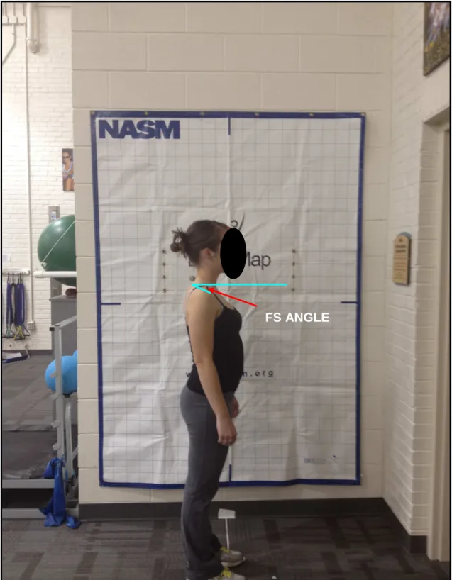 FIGURE 3:  Forward Shoulder Angle (FSA) 