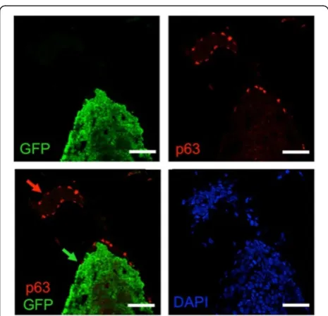 Figure 8 The myoepithelial layer is murine in humanizedglands. Ducts humanized with 4G-shp53 cells were costained forp63 (red), GFP (green) and DNA (DAPI, blue) (n = 3)