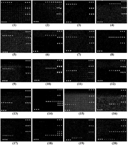 FIG. 3. Microarray differentiation of reference strains belonging to different E. coli(G1185); 19,coli(G1235); 8,O6 (G1062); 2, O serogroups and S