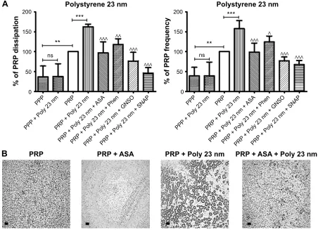 Figure 9 Quartz crystal microbalance with dissipation. Effects of 23 nm polystyrene nanoparticles on platelet microaggregation.Notes: (A) Quantitative analysis of the effects of perfusion of PPP and PRP in the presence or absence of 23 nm polystyrene nanop