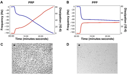 Figure 1 Quartz crystal microbalance with dissipation. Perfusion of PRP leads to platelet microaggregation