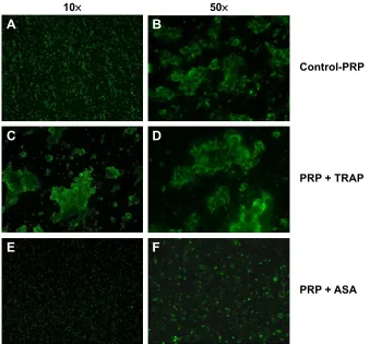 Figure 4 Immunofluorescence microscopy. Effects of TRAP and ASA on platelet aggregation