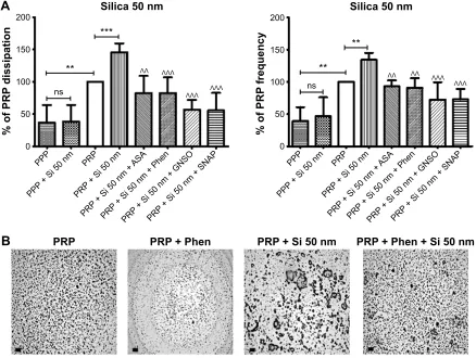 Figure 8 Quartz crystal microbalance with dissipation. Effects of 50 nm silica nanoparticles on platelet microaggregation.Notes: (A) Quantitative analysis of the effects of perfusion of PPP and PRP in the presence or absence of 50 nm silica nanoparticles a