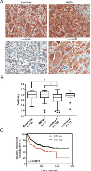 Figure 5: Expression of CIP4 varies between TNBC subtypes and is linked to risk of metastasis