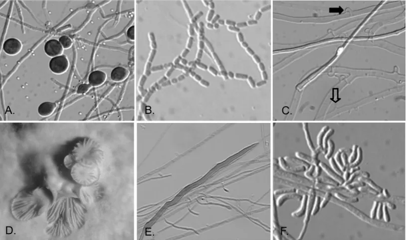 FIG. 1. Typical morphological features of basidiomycetes in culture. The morphological features that basidiomycetes may display in culture areshown
