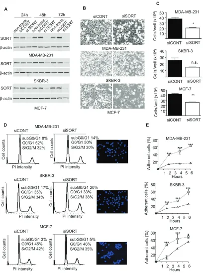Figure 4: Impact of sortilin knockdown on proliferation, survival and adhesion of breast cancer cells