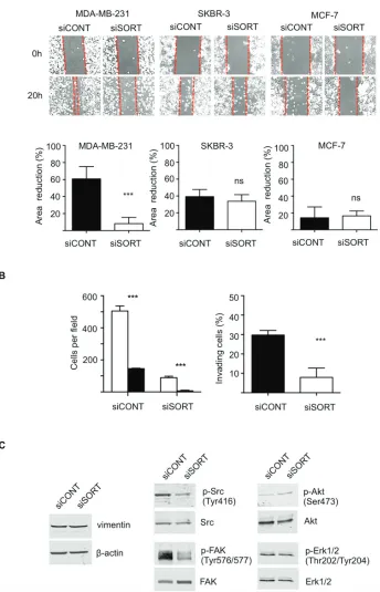 Figure 5: Impact of sortilin knockdown on migration and invasion of breast cancer cells
