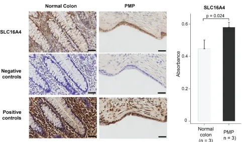 Figure 3: In-situon high power images. Data in the graphs represent the mean ± SD for SLC16A4 expression by PMP versus normal colonic mucosa