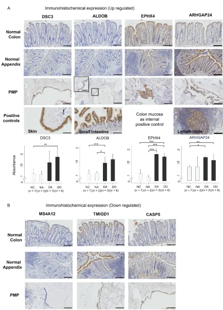 Figure 4: Immuno-histochemical staining for protein product expression of  (A) up-regulated genes (DSC3, ALDOB, EPHX4, ARHGAP24) and (B) down-regulated genes (MS4A12, TMIGD1, CASP5) in normal colon (NC) and normal versus normal epithelia groups (NC, NA) (*