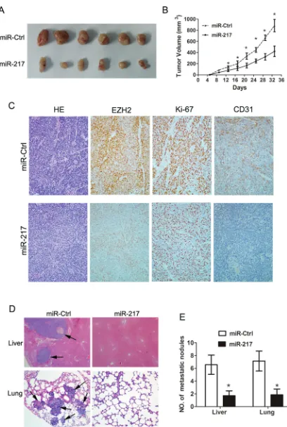Figure 4: Ectopic miR-217 expression inhibits tumor growth and metastasis in vivosignificantly reduced tumor weights and volumes of SGC7901 cells (*miR-217 (SGC7901/miR-217) demonstrated significantly weaker staining of EZH2, Ki-67, and CD31 than those for