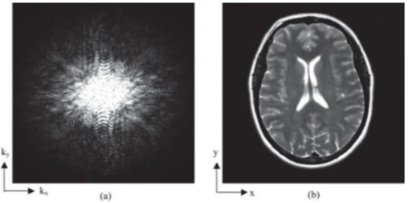 Figure 2.7: ܭ-space data (a) and the reconstructed image after IFFT (b) [13, p. 148].