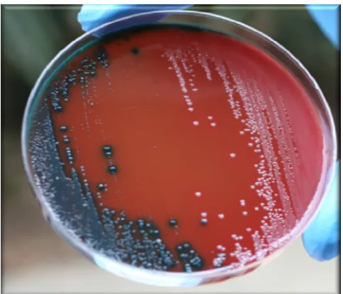 TABLE 1. Detection of Tox� colonies from 50 cytotoxicity assay-positive samples on the Cdifftox agar plates at different timesa