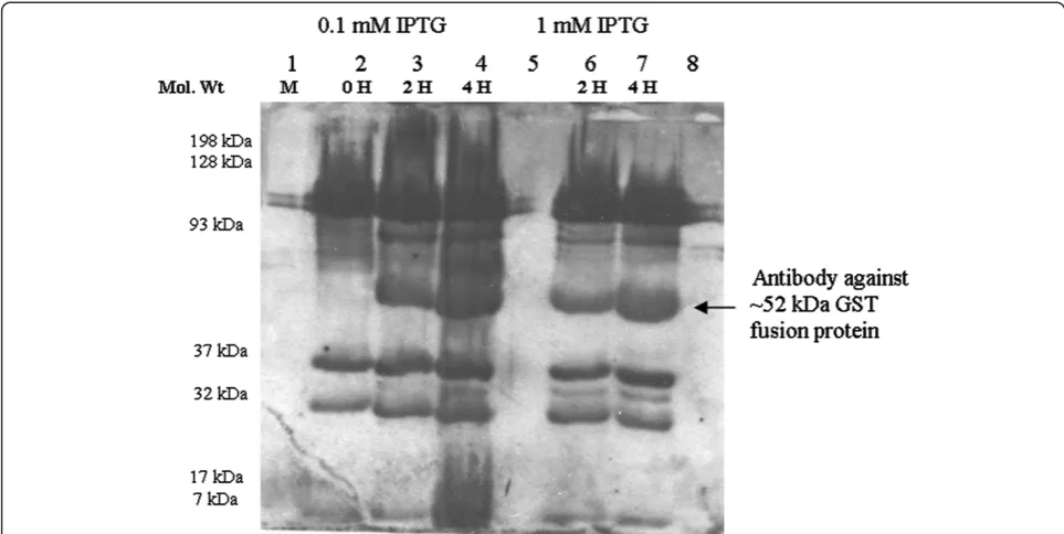 Figure 5 SDS-PAGE showing different purification steps forfusion protein from pellet after sonication step III (P-III)