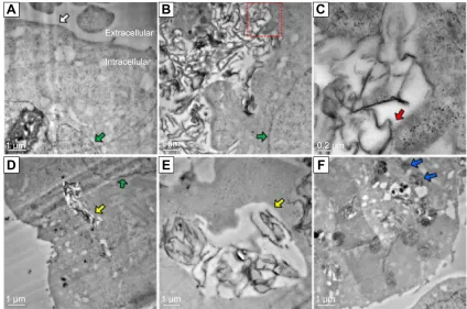 Figure 9 cellular uptake and internalization of nanomaterial observed with TeM.Notes: McF-7 cells were untreated (A) or treated with Pssg (10 μg/ml) for 3 hours (B and C) and 24 hours (D–F) before TeM examination