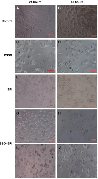 Figure 5 real time morphology observations of McF-7 cells.Notes: control group (A and B)
