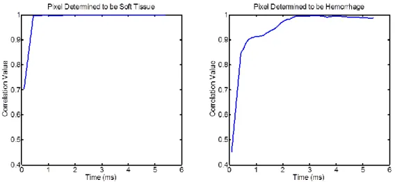 Figure  2.2:  Correlation  values  measured  in  soft  tissue  and  hemorrhage  over  ARFI  observation  period