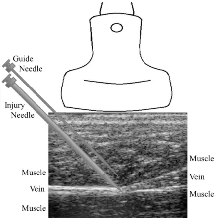Figure  3.1:  Placement  of  the  imaging  transducer  and  needles  during ARFI monitored hemostatic challenge