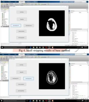 Fig 4. Skull stripping results of base method 
