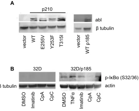 Figure 2.1: IKKβ inhibitor CpA blocks phosphorylation of IκBα in BCR-ABL-