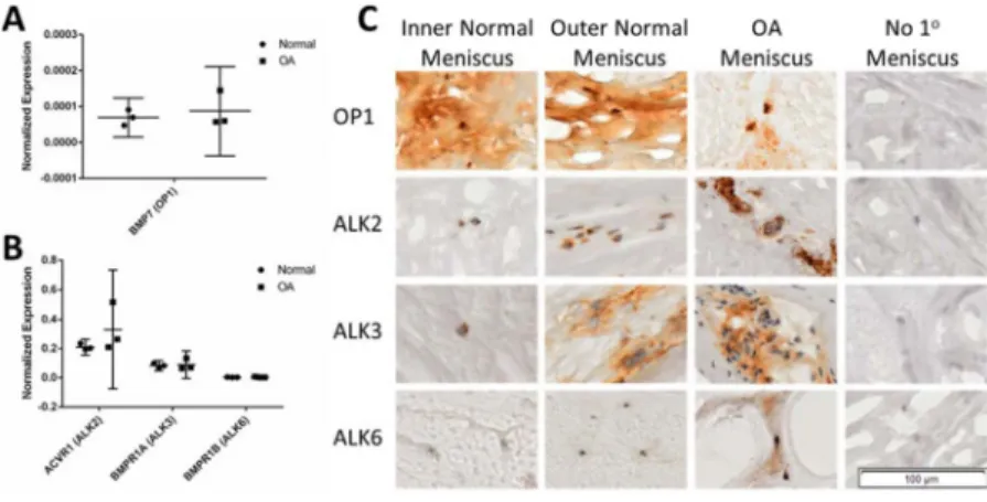 Figure 1. OP1 dose effect on gene expression in normal and OA meniscus cells