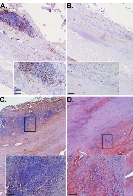 Figure 1: distribution of differentially expressed genes in aortic aneurysmal and occlusive disease