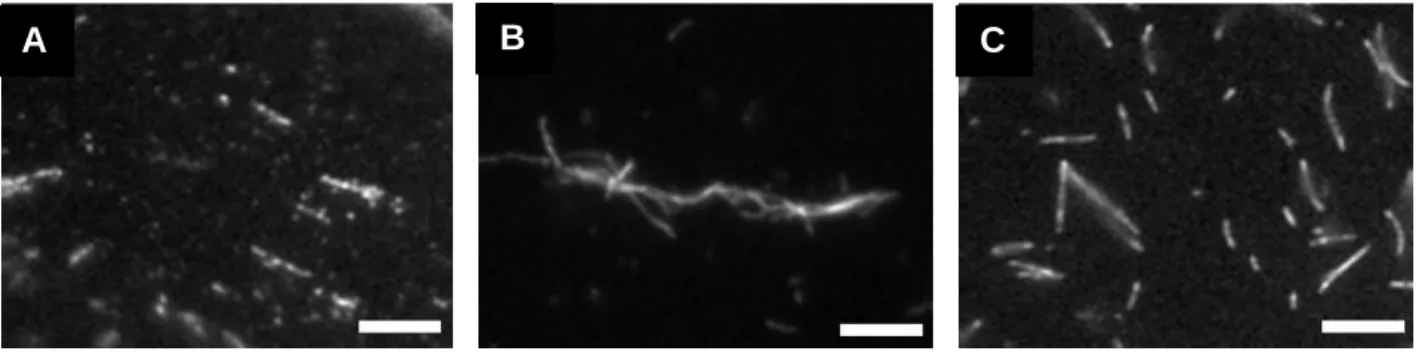 Figure 2.3.Visualization of actin bundles in the presence and absence of WT Vt and VtΔC5  using fluorescence microscopy