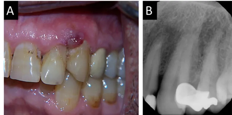 Figure 1. Clinical and radiographic findings at initial presentation