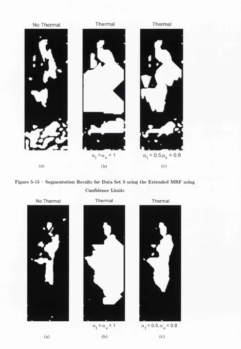 Figure 5-15 -  Segmentation Results for Data Set 3 using the Extended MRF using