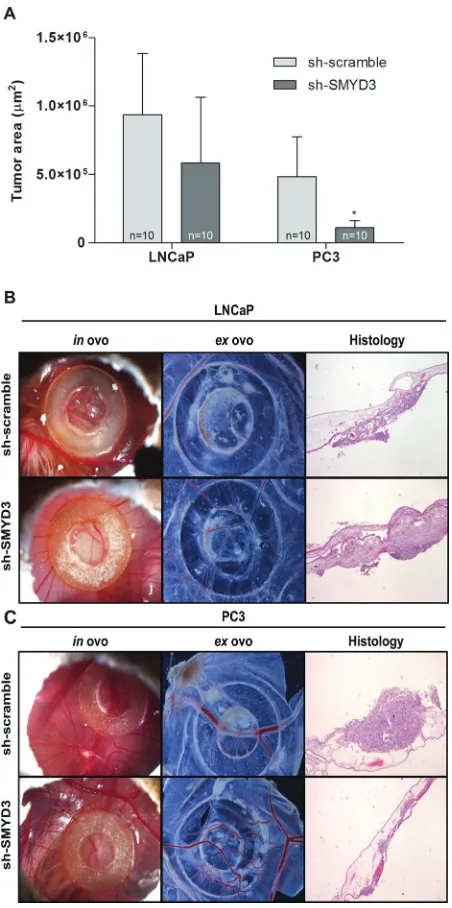 Figure 3: In vivoof tumor areas measured in histological sections. (C) sh-scramble or sh-SMYD3 cells ( effect of SMYD3 silencing in tumor formation and angiogenesis in PCa cell lines
