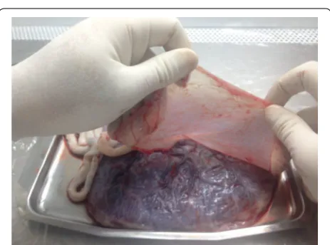 Fig. 1 The position of placing placenta in a sterile container in which the fetal surface was faced up