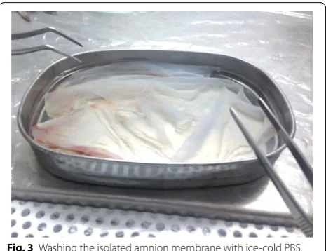 Fig. 3 Washing the isolated amnion membrane with ice-cold PBS