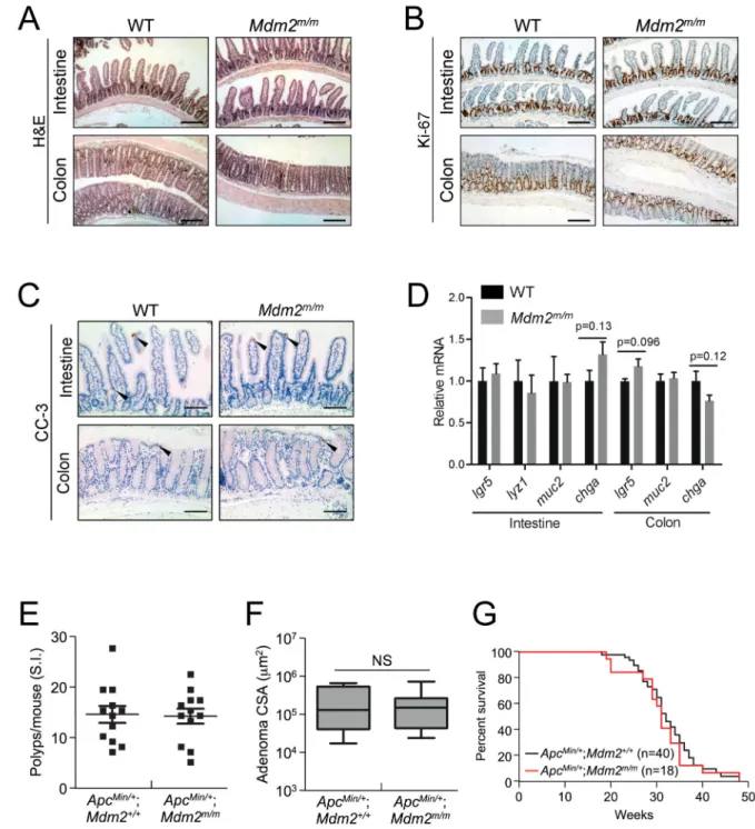 Figure 1. MDM2 C305F mutation has no discernable effect on APC loss-induced small intestinal  tumors