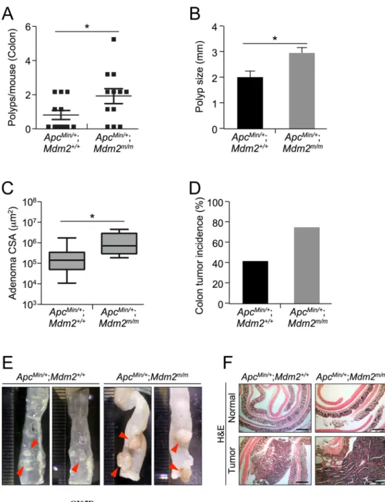 Figure 2. MDM2 C305F  mutation increases prevalence of APC loss-induced colon cancer A