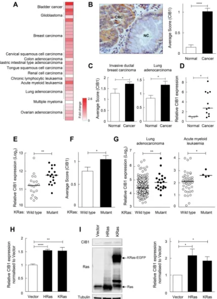Figure 1. CIB1 expression is elevated in multiple cancers and is associated with oncogenic Ras  mutation