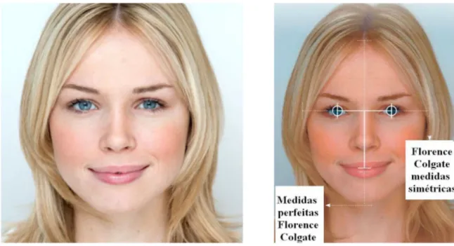 Figure 1.1. Florence Colgate’s face, before and after analysis. “Britain’s Most Beautiful Face  Reveals Beauty Secrets?” Redefining the Face of Beauty