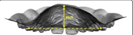 Fig. 4 Representation of the measurements of the intermolar width(IMW) and arch length (AL)