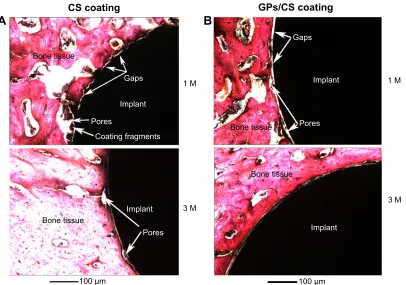 Figure 6 TEM observations of the GPs in the composite coating.Notes: (A) Shows that the GPs existed in the interface or were semi-wrapped on the CS particles, and (B) exhibits that the GPs bridged the CS particles