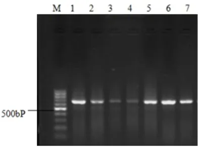 Figure 2. Verification of 7 mtDNA templates selected randomly by electro-phoresis, M is DNA Marker DL15000, band 1 is an mtDNA template selected randomly, with a size of 16,569 bp.