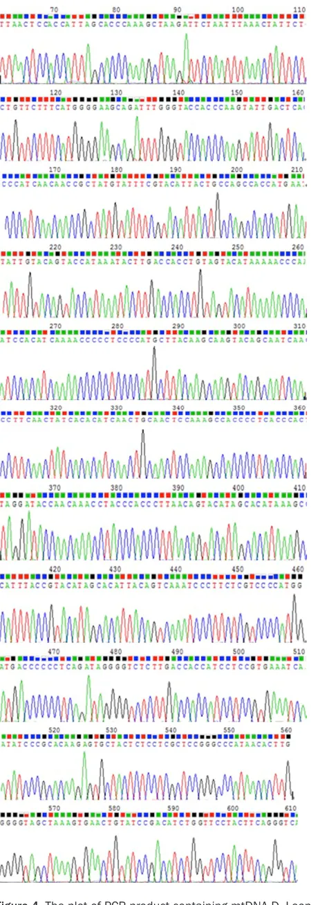Figure 4. The plot of PCR product containing mtDNA D. Loop HVS I by single direction sequencing
