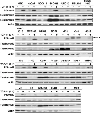 Figure 7Transforming growth factor (TGF)-β1 induced Smad2 phosphorylation in many cancer and noncancer cell strains