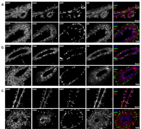 Figure 2 Expression of lineage markers in mammary glands of MMTVrtTA/H2BGFP mice. Mammary glands were harvested fromfour-week-old double transgenic females treated with doxycycline, sectioned and immunostained for: (a) β1 integrin (b) CK8 (c) CK14 or (d) p