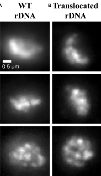 Figure 3. Qualitative analysis of nucleolus area. Simulation results con- con-verted to microscope images (see ‘Materials and Methods’ section)